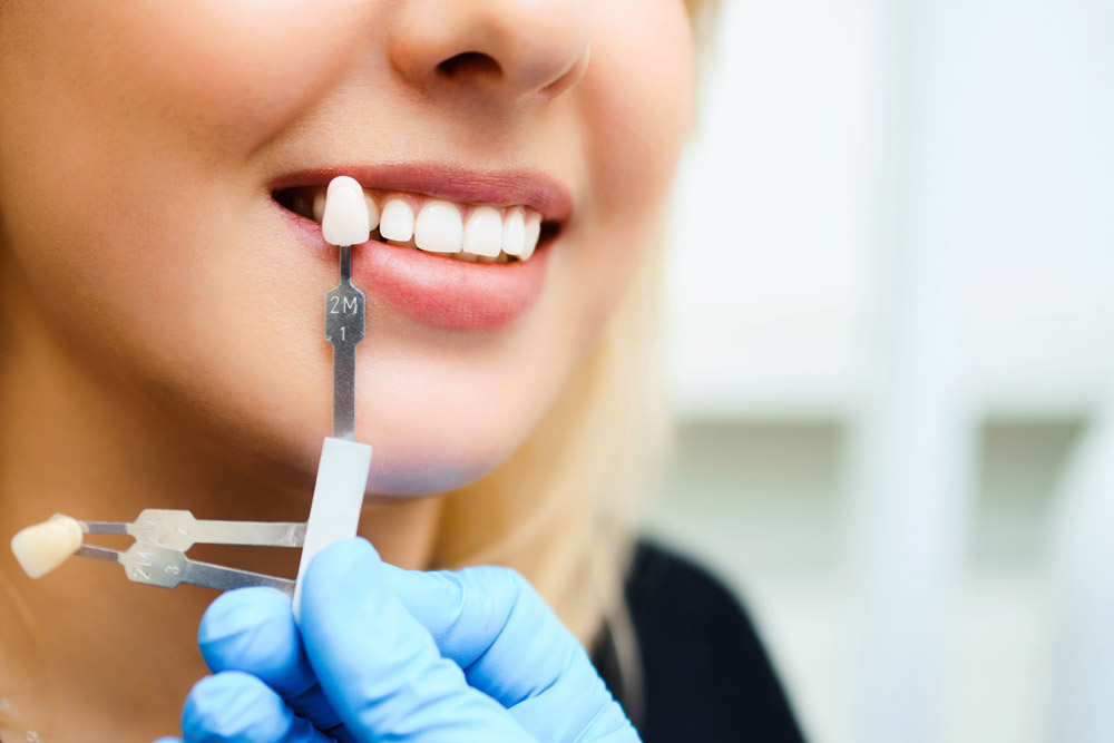 牙齿断裂做全瓷牙修复有哪些优点