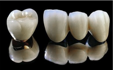 全瓷牙“散发通透之光”的美牙技术