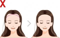 发际线调整：费用多少及效果评估