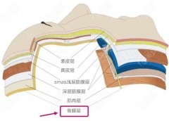 怎么样选择玻尿酸丰面颊？费用多少？效果如何？
