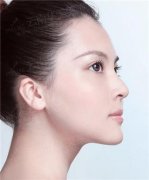 双胞胎姐妹注射美容实验，十三年后效果对比引深思
