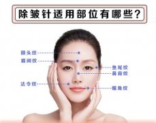 面部光纤溶脂术后消肿期及护理指南