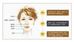 镭射净肤：价格解析与效果评估