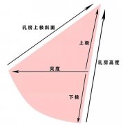 麦格假体丰胸效果如何？费用多少？