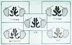 歪鼻矫正手术：效果如何？费用多少？