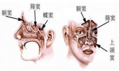 硅橡胶隆鼻效果如何？费用解析及持久性探讨