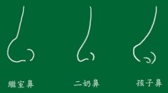 耳软骨垫鼻尖效果如何？费用多少？