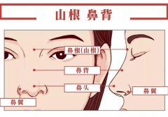 隆鼻修复：怎么样选择较好方案与费用考量