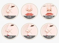假体隆鼻手术效果怎么样：塑造立体轮廓的秘诀