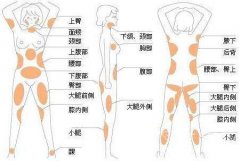 大腿吸脂手术：效果如何？术后恢复与注意事项详解