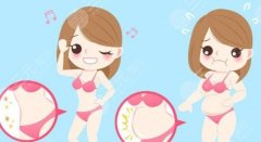 面部吸脂手术怎么样？费用多少及术后恢复指南