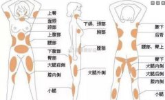全方位吸脂塑形效果如何？其费用范围是多少？
