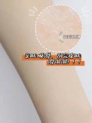 手臂激光脱毛费用解析及效果评估