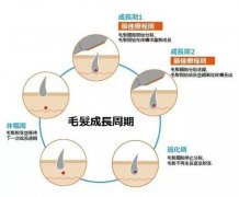 冰点脱毛后的影响有哪些？深入解析其效果与护理
