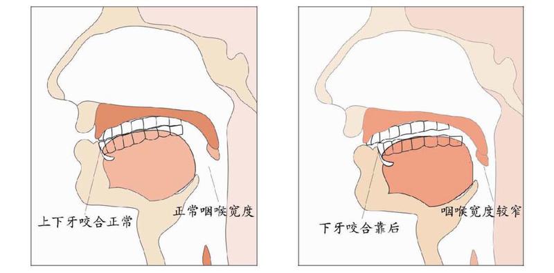 长治悦美整形医院朝天鼻矫正术安全吗 大概多少钱