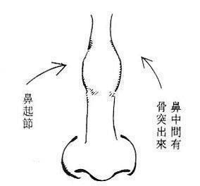 隆鼻和鼻综合有什么不同？选择哪一种手术方式更好？