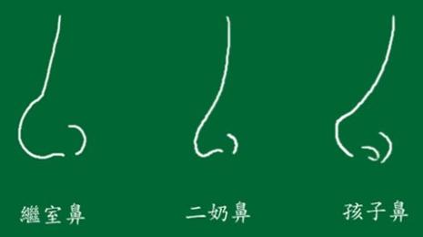 鼻子的美可是至关重要 看看这些需要改善的鼻子