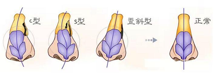 郑州整形医院价目表明细曝光~扒来了2025新版
