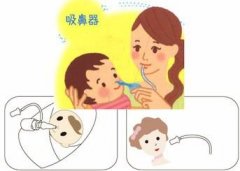 怎么样才能注射隆鼻？适宜人群、优势、注意事项全在这里了！