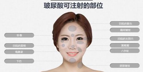 苏州玻尿酸丰胸手术价格表：价格表曝光，是否昂贵一看便知