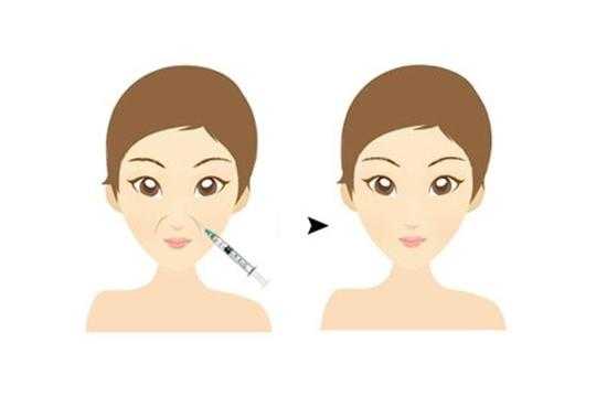 胶原蛋白丰唇价格和玻尿酸丰唇的价格哪个更划算？