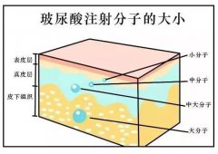 除皱针与玻尿酸哪个更好