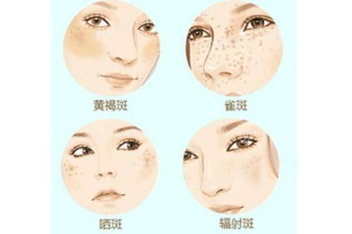 彩光嫩肤效果好不好 怀化天姿整形医院正规吗