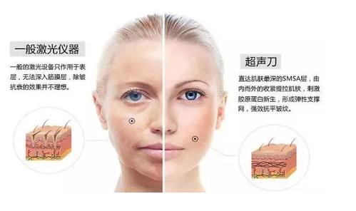 超声刀美容手术价格表：了解快速手术的费用多少及可能的价格差异
