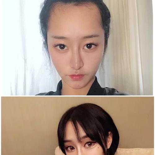 深圳青逸医疗美容医院价目表一览丨专家名单丨发际线种植案例~