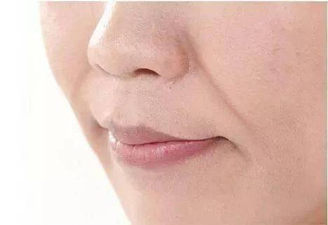 法令纹重！消灭法令纹的一些方法教你，学起来~
