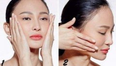 出现法令纹怎么改善？注射玻尿酸、适当增重、热玛吉等来进行调整