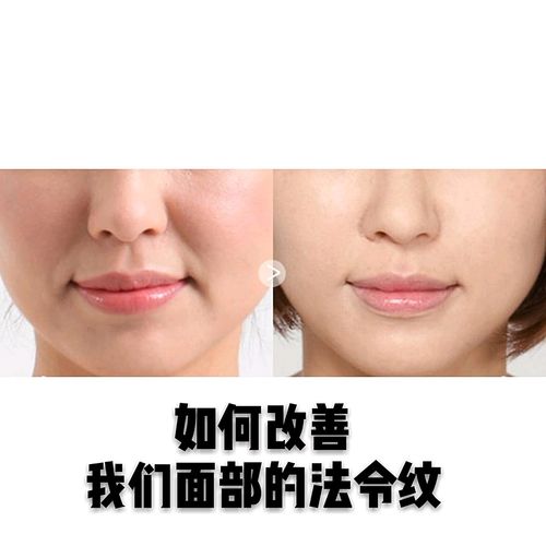 玻尿酸填充法令纹的价格表：价格表及收费标准，是否值得投资？