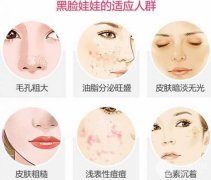 黑脸娃娃痛吗