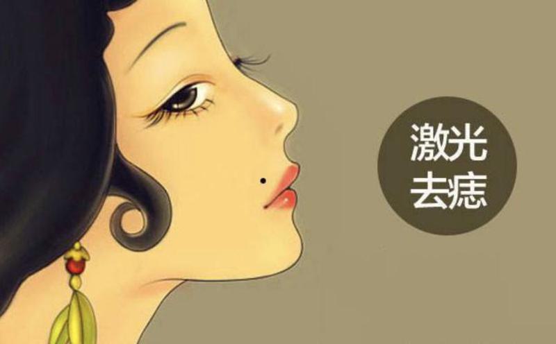 成都激光点痣多少钱？附成都激光点痣价目表
