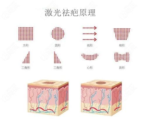 常春藤医疗美容医院价目表一览：各种美容项目费用详细解析，价格贵吗？