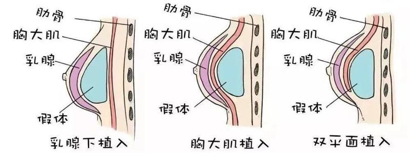 自贡第四人民医院整形科价目表2025更新，医生+案例评价一览！