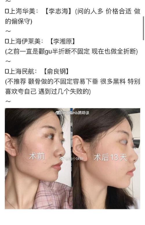面部改脸型手术价格表：价格表及术后护理注意事项，是否值得投资？