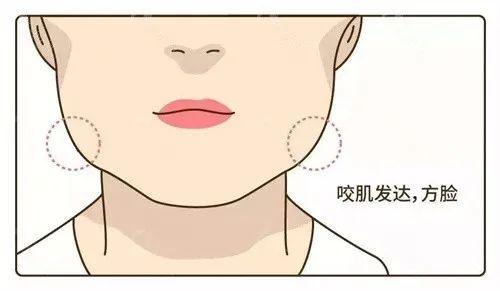 曲靖下颌角整形价格表更新｜医院简介（曲靖下颌角整形整形医院选哪家）