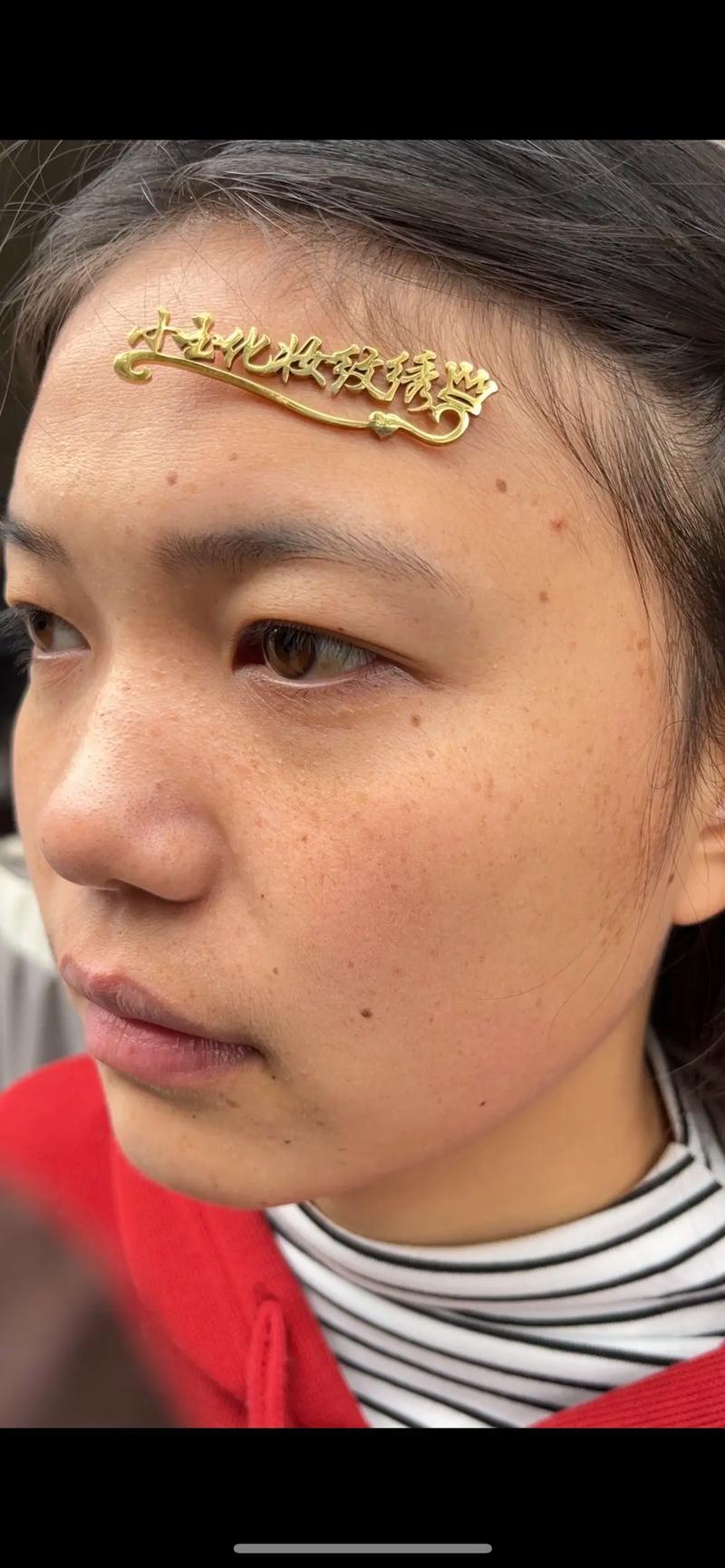 祛斑不反弹，除了激光还有什么好的办法？