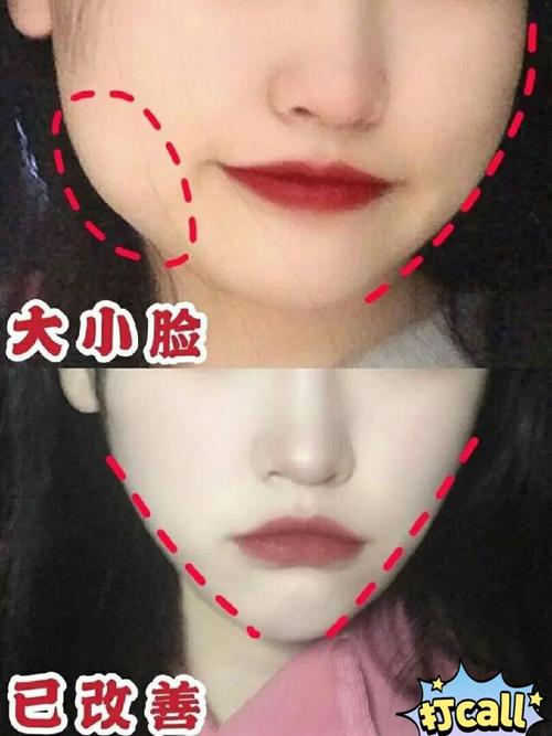 张掖肚子打溶脂针价格需多少(张掖肚子打溶脂针的大概费用是多少)