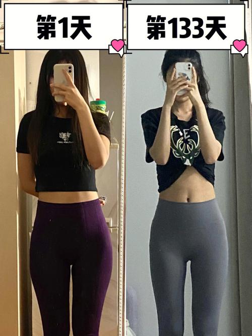 腿粗的姑娘们，怎么才能让小腿瘦下来呢？看看瘦小腿的医美方法