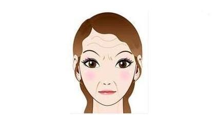 额头纹怎么消除 广州紫馨整形医院激光去皱消灭你的抬头纹