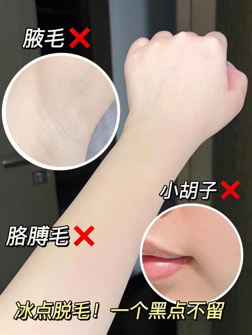 福州美贝尔脱毛靠谱吗 激光脱腋毛有哪些优势