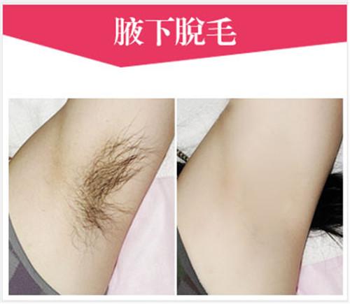 泰安中心医院美容整形科脱毛价位+案例真实反馈，夏天必备！