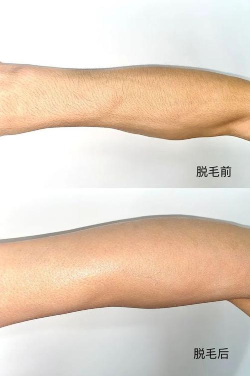 私密整形手术价格表：膜修复手术价格表及手术方式详细解析