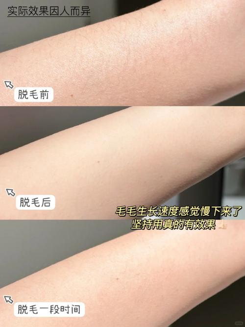 青医附院美容中心价目表，预约挂号方式
