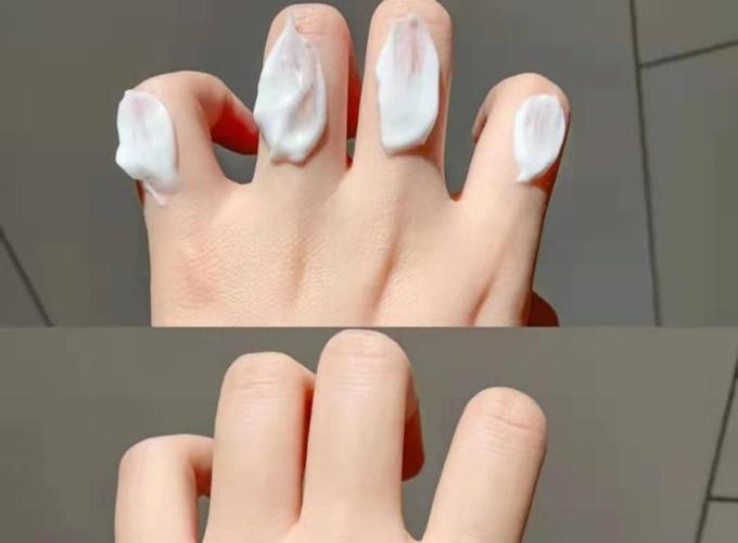 冰点华尔兹脱毛：永.久性效果及价格曝光！