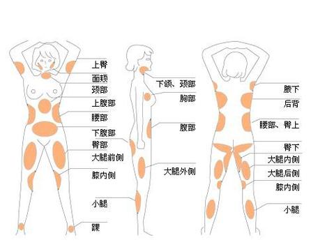 大腿吸脂手术需要多久？全部手术治疗流程方法步骤