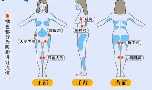 150医院美容整形科医生介绍及整形项目价格表表，价格实惠吗？