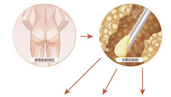 #宁波113医院美容怎么样#口碑评价+新版价目表在线一览~